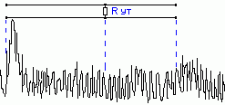 sinch3.gif (1722 bytes)